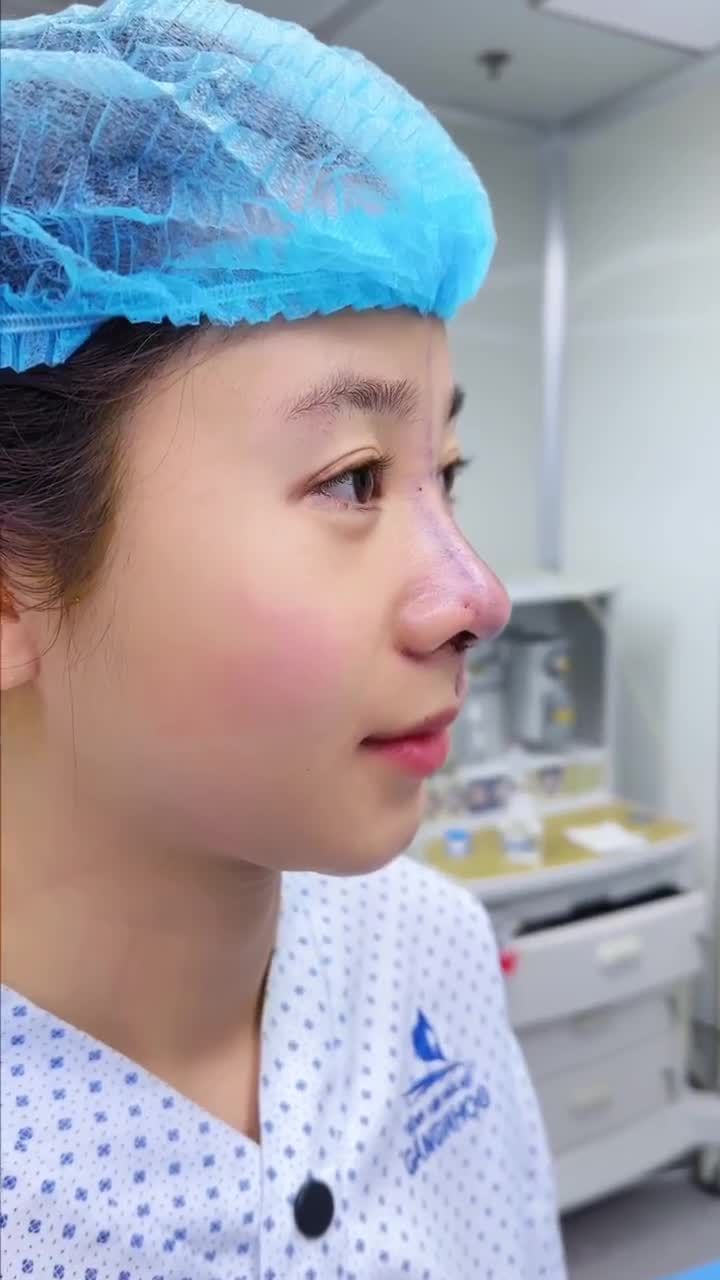 BẠN NỮ LỘT XÁC NHAN SẮC CHỈ SAU 60 PHÚT NÂNG MŨI TẠI GANGWHOO – DÁNG MŨI HÀI HÒA, GƯƠNG MẶT VƯƠN TẦM ĐẲNG CẤP!