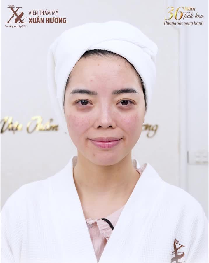 Trăm lời quảng cáo không bằng hình ảnh chân thật từ khách hàng trải nghiệm công nghệ  trẻ hoa da Renew Face