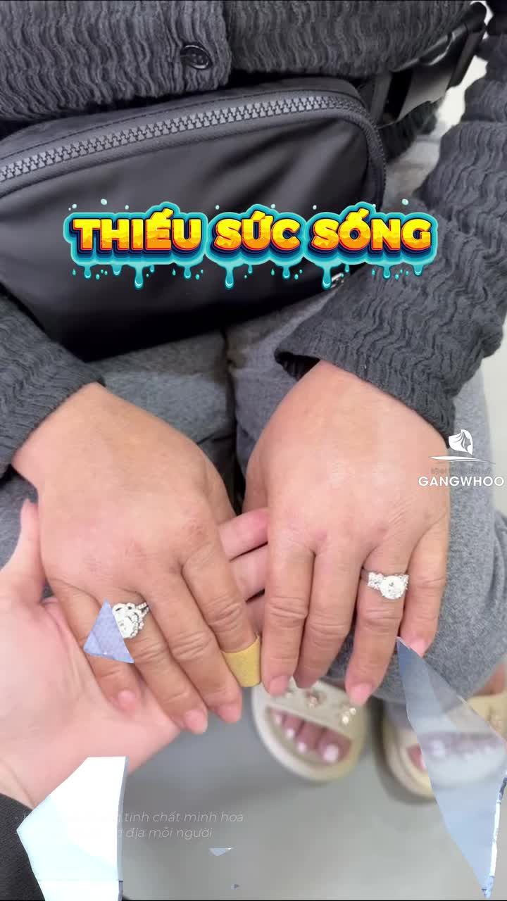 Kết quả cấy mỡ bàn tay tự thân sau 10 ngày