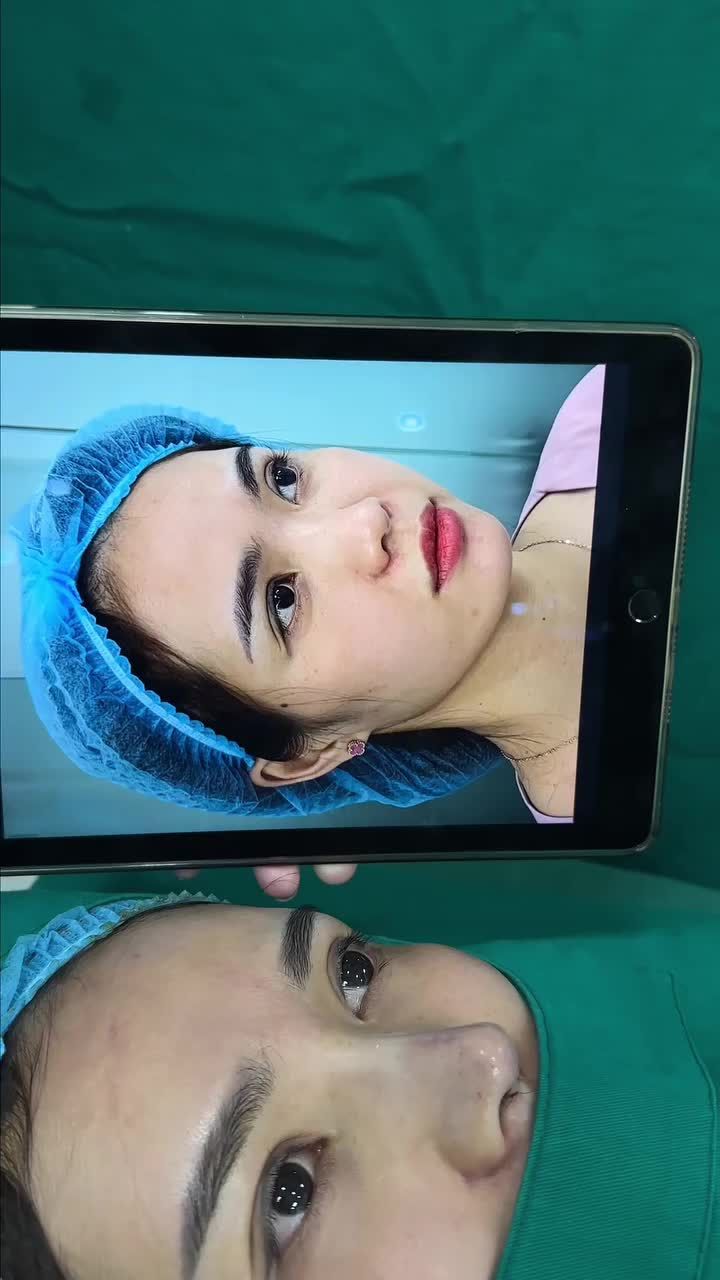 Chị Huyền bảo rằng: mong muốn có dáng mũi cao bay mà vẫn tự nhiên hợp với gương mặt.