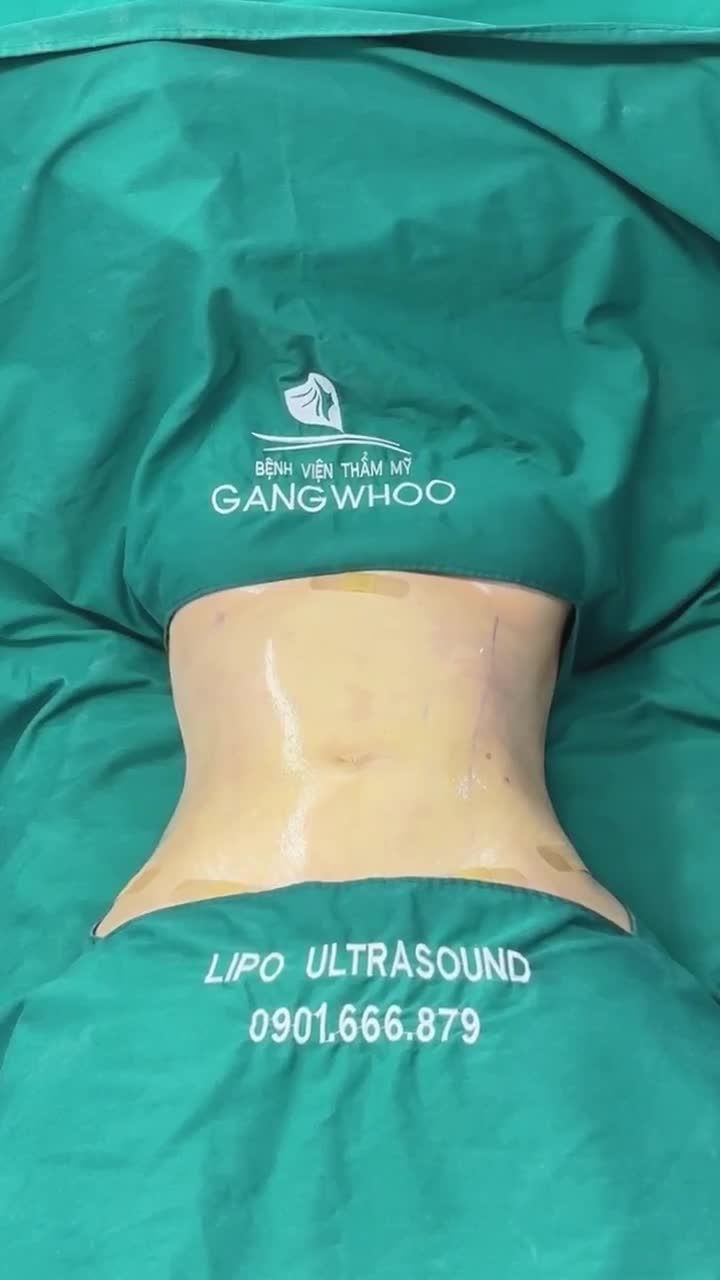 HÀNH TRÌNH LẤY LẠI VÒNG EO THON GỌN CỦA CHỊ M. TẠI GANGWHOO – DÁNG BỤNG SĂN CHẮC SAU 60 PHÚT!