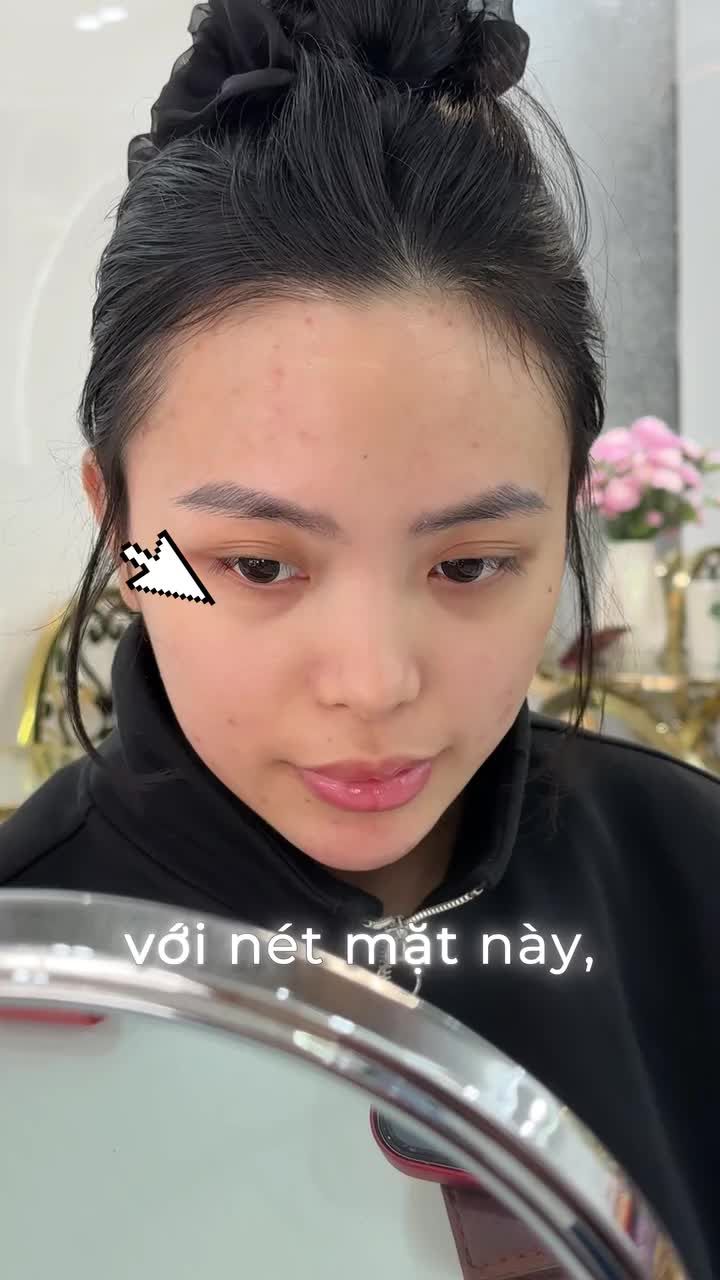 Dáng mũi với phần sơn căn thấp không tốt cho phong thủy Bé khách quyết định nâng mũi để cải thiện.