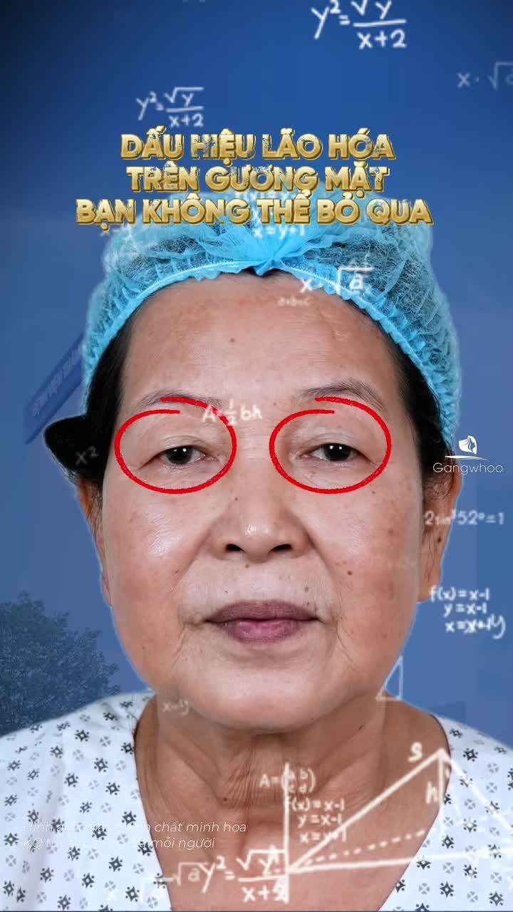 Lão hóa mắt không chỉ là vấn đề thẩm mỹ, mà là cả chất lượng cuộc sống... Đăng ký lịch hẹn cùng Bác sĩ chuyên khoa ngay hôm nay để tìm giải pháp an toàn và hiệu quả nhất!