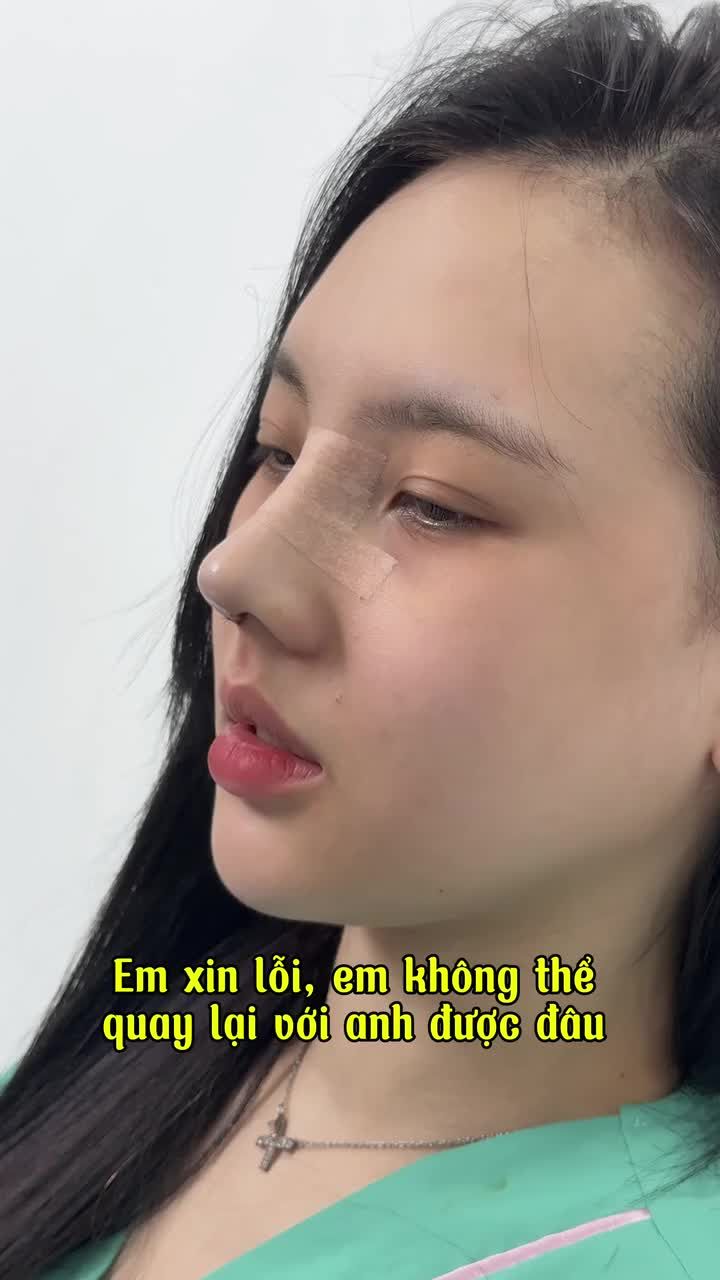 Xinh đẹp hơn, tự tin hơn với dáng mũi cao đẹp, thanh tú.