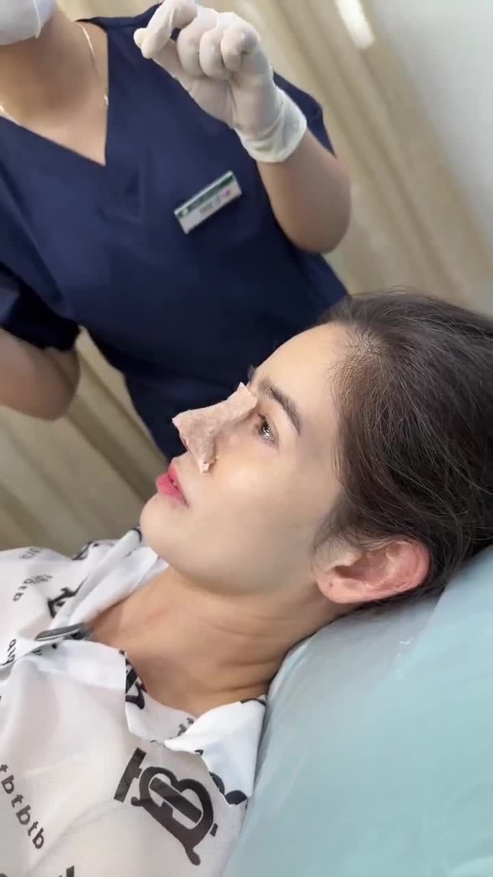 KHOE MŨI ĐẸP NGAY KHI THÁO NẸP!
