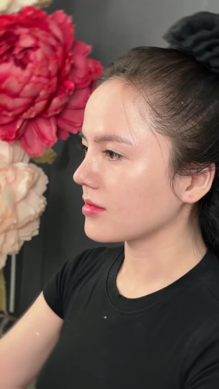 Mũi cấu trúc 3 tái khám - Vào form chuẩn đẹp!!