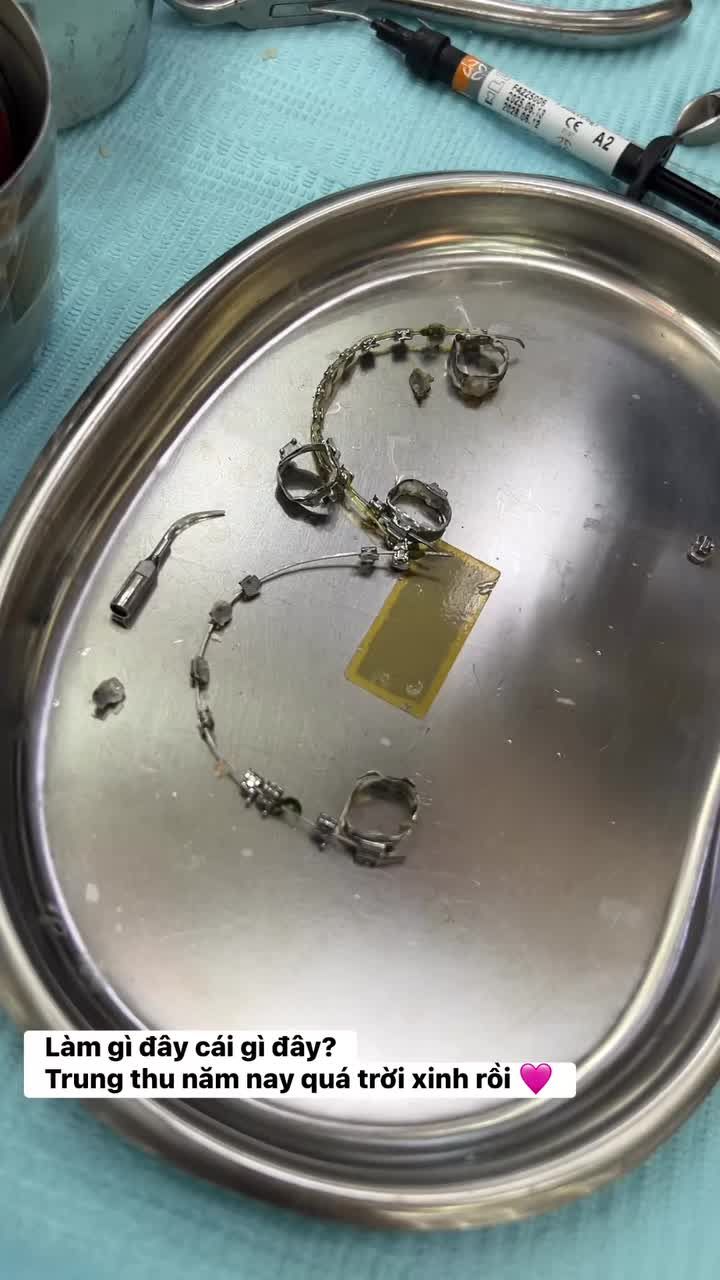 Tạm biệt mắc cài, tạm biệt hội đồng niềng, mình gia nhập hội răng đẹp đây!