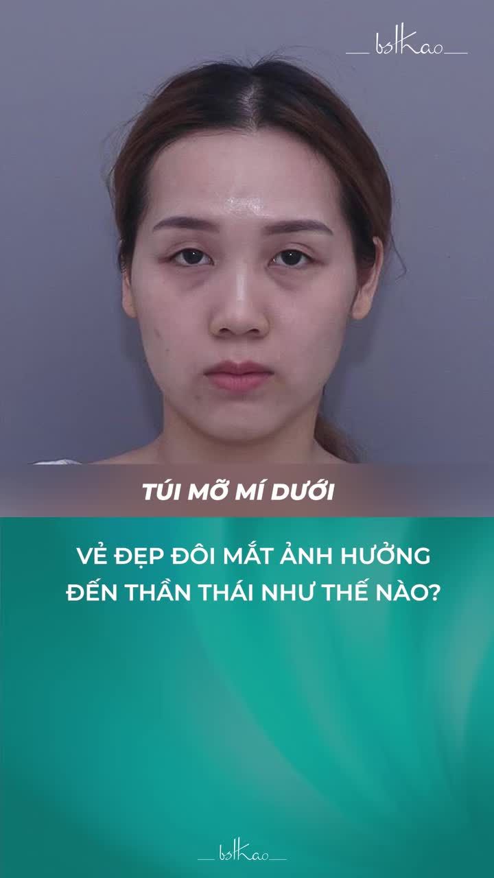 VẺ ĐẸP CỦA ĐÔI MẮT ẢNH HƯỞNG ĐẾN THẦN THÁI KHUÔN MẶT NHƯ THẾ NÀO?