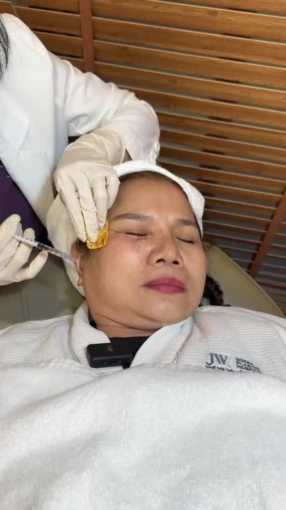 U50 miền Tây quyết tâm lấy lại làn da CĂNG BÓNG, MỊN MÀNG như gái 18 với dịch vụ TIÊM MESO tại JW