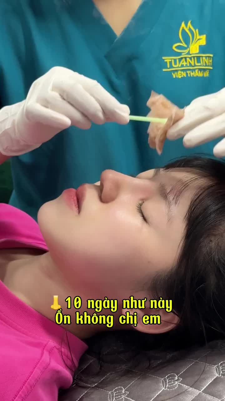 MŨI 10 NGÀY VÀO FORM CHUẨN ĐẸP!!