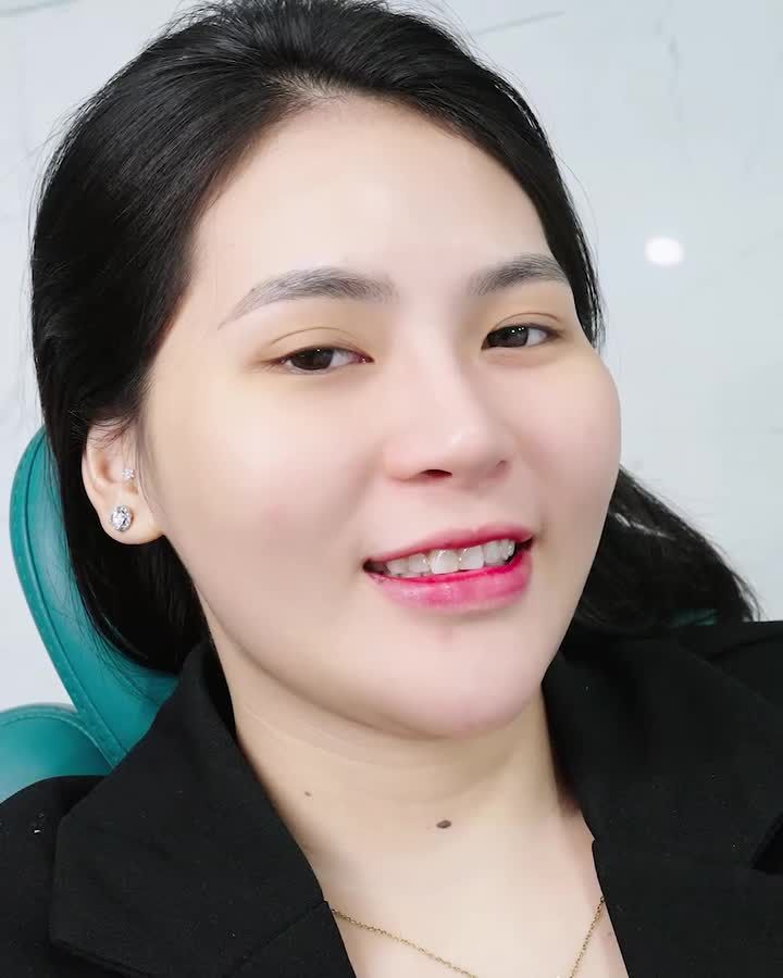 HÀNH TRÌNH THAY ĐỔI NỤ CƯỜI CÙNG LAVA ESTHETIC