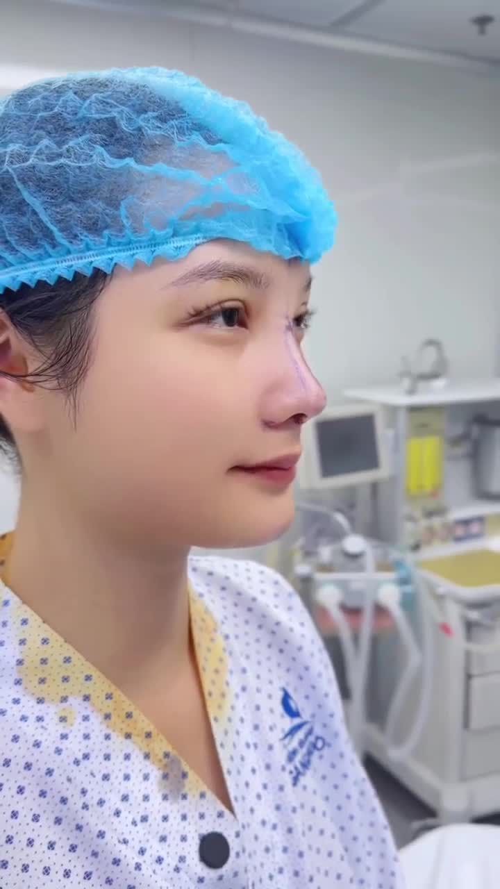 CÔ GÁI 26 TUỔI LÊN ĐỜI NHAN SẮC SAU 60 PHÚT NÂNG MŨI TẠI BỆNH VIỆN THẨM MỸ GANGWHOO – DÁNG MŨI L-LINE, GƯƠNG MẶT SẮC SẢO!