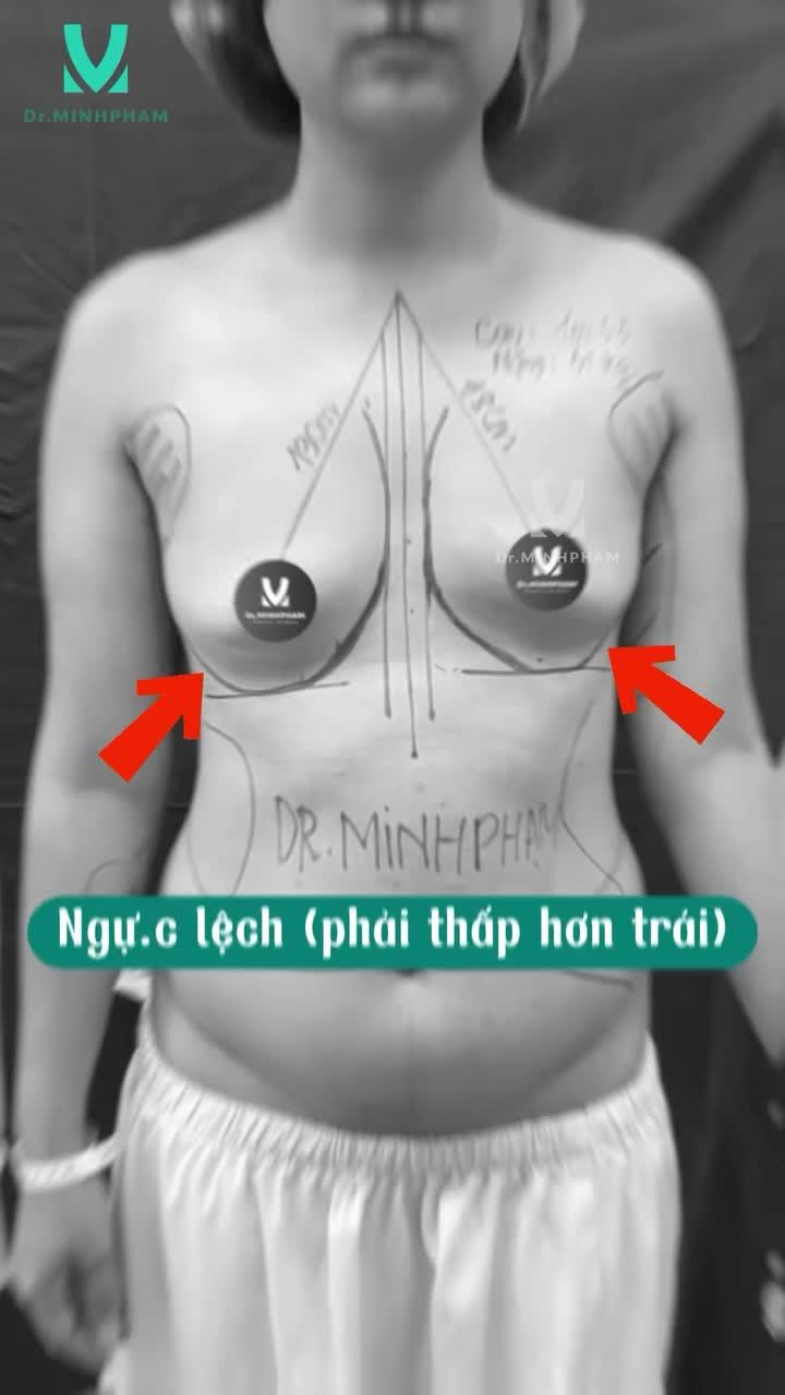 Một lần "chạm" - Hai lần thăng hạng nhan sắc