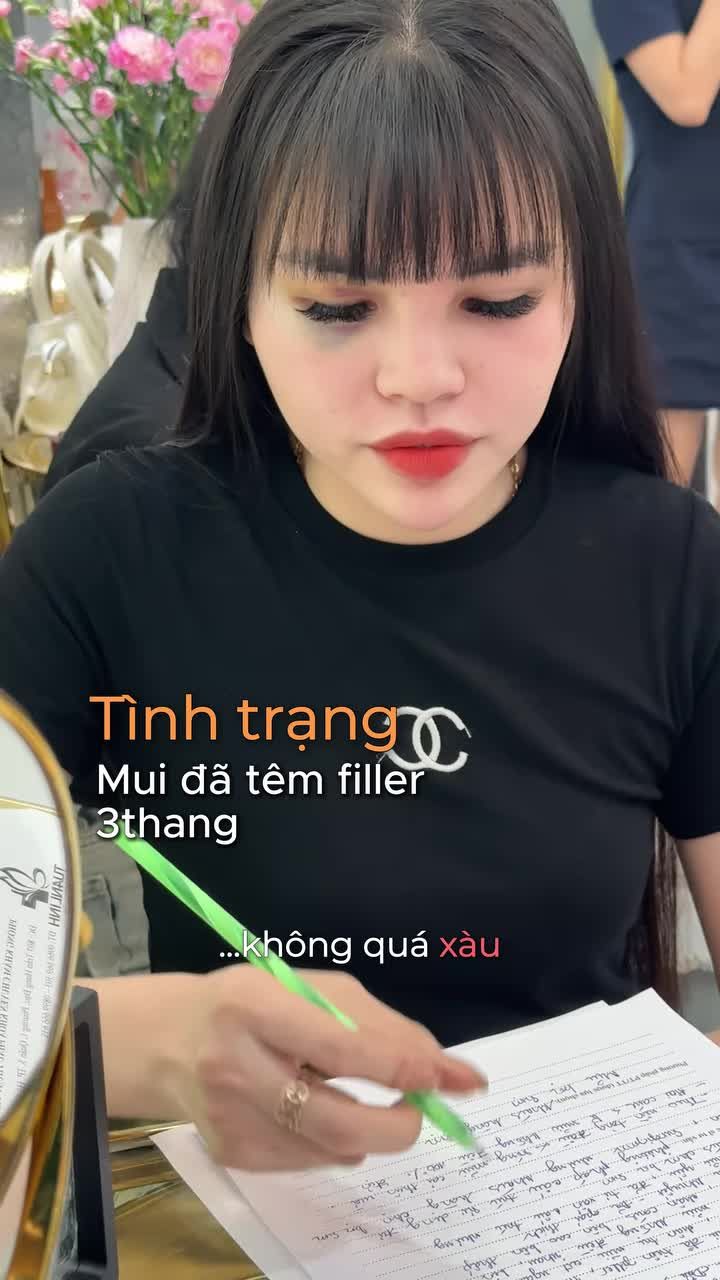 Tiêm filler không lên được dáng mũi ưng ý, filler bị tràn, bè, dáng mũi đỡ thô đã được khắc phục hoàn toàn chỉ sau 60 phút.