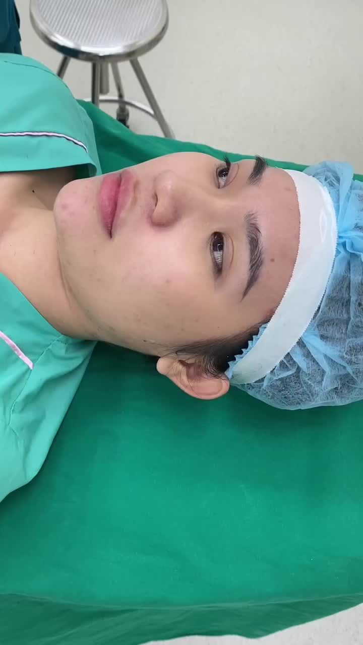 Quyết định nâng mũi chỉ sau 1 ngày tìm hiểu - Và lựa chọn Tuấn Linh để thực hiện đủ thấy độ uy tín như thế nào rồi đúng không ạ?