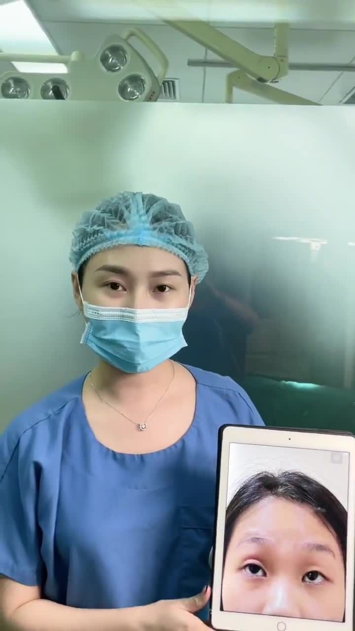 Sau nhiều năm sống chung với đôi mắt sụp mi, cô gái sinh năm 2001 cuối cùng đã chạm tới ước mơ – đôi mắt to tròn, nếp mí cân đối và tự nhiên.