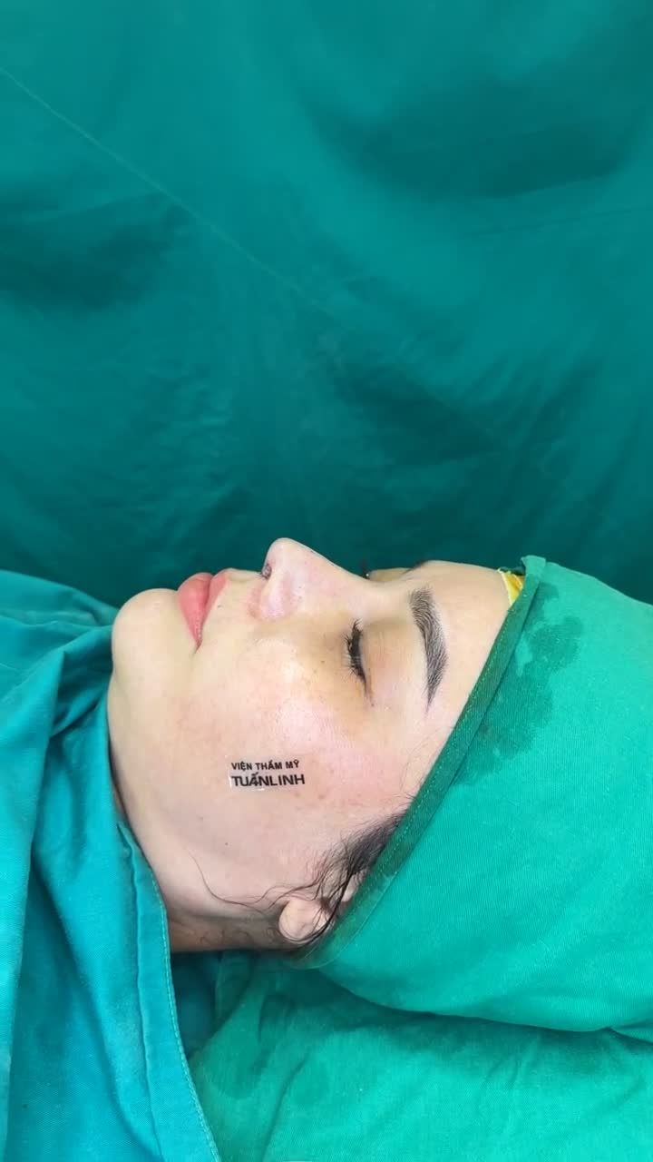 Case tái cấu trúc Surgiform vừa hoàn thành!!