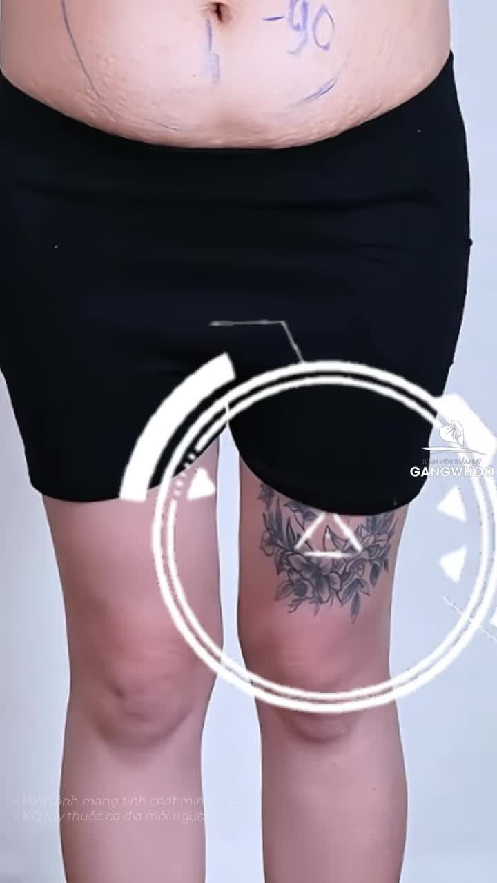 Công thức đi biển không ngại diện bikini chính là đến Gangwhoo giảm mỡ bụng nhé các chị em