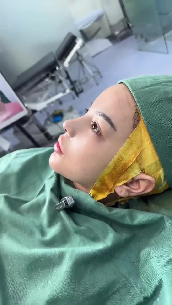 KẾT QUẢ SAU 60 PHÚT NÂNG MŨI CẤU TRÚC KH. PHƯƠNG TRINH (QUẬN 7)