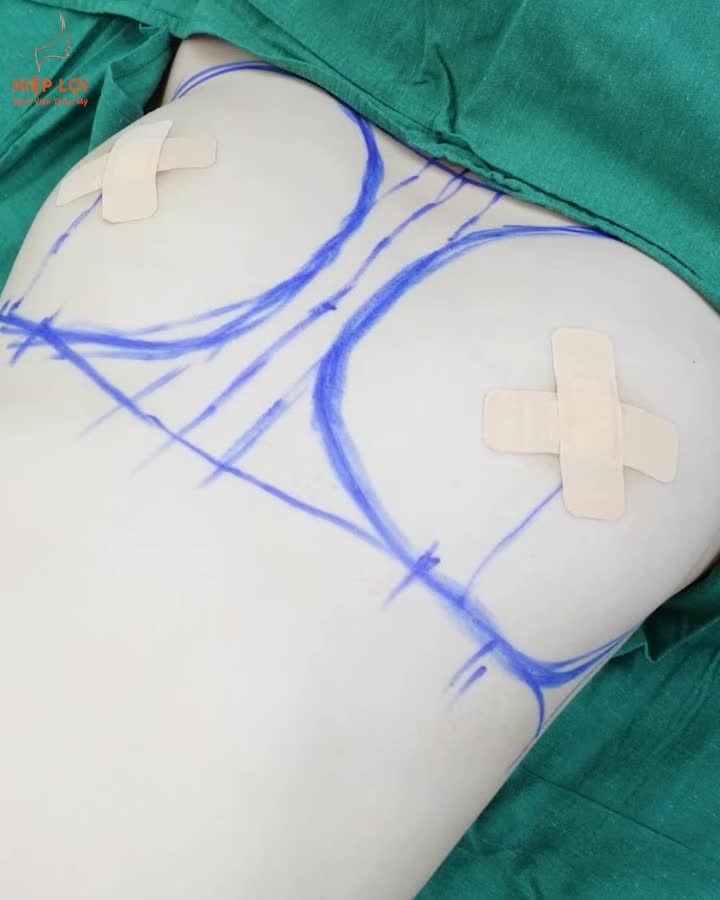 MÀN “LỘT XÁC” GÂY MÊÊÊÊÊ