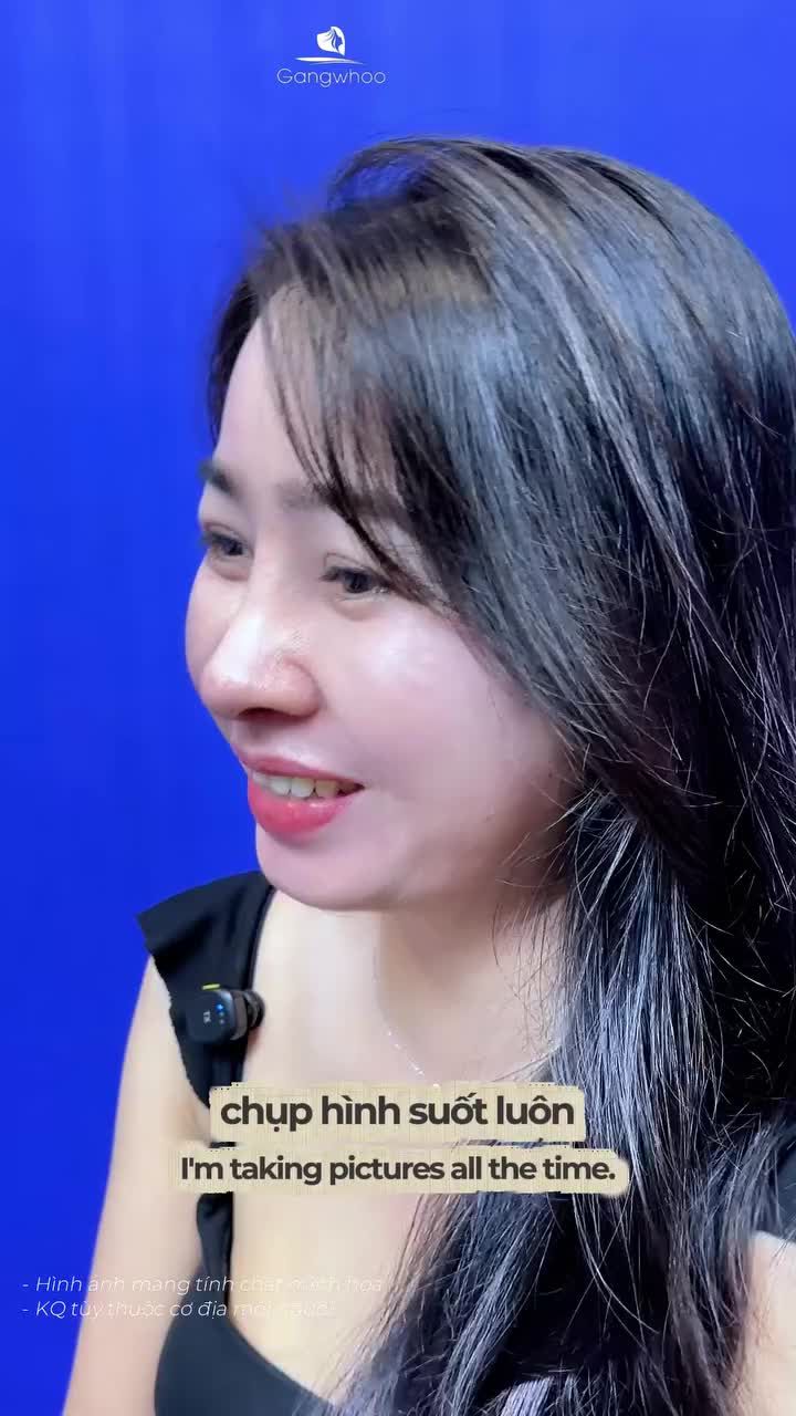 Như thay đầu sau nâng mũi, đẹp không nhận ra