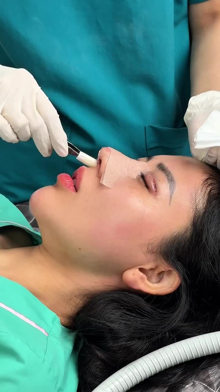 Dáng mũi cao tây, nếp mí to tròn đẹp sắc nét Combo tái sinh gương mặt đẹp hoàn hảo!!