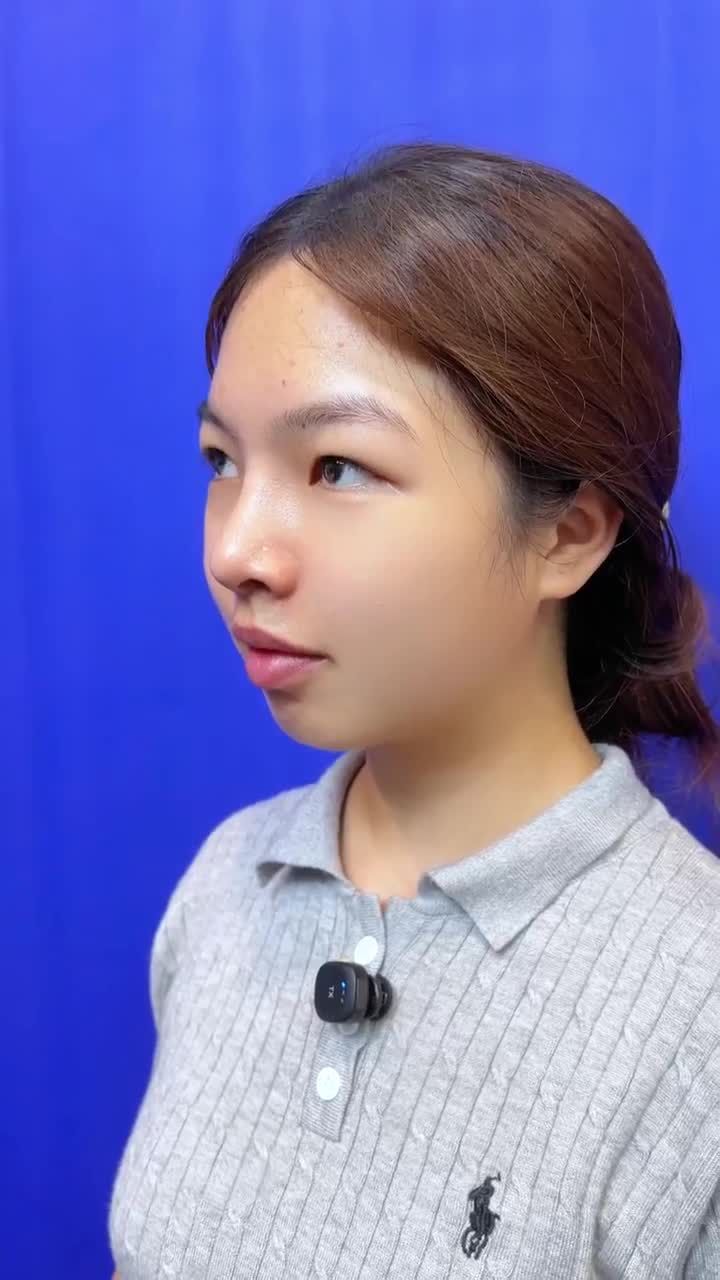 CHỊ KHÁCH HÀNG LỘT XÁC DIỆN MẠO SAU 1 THÁNG NÂNG MŨI TẠI BỆNH VIỆN THẨM MỸ GANGWHOO – DÁNG MŨI HOÀN HẢO, TỰ TIN TỎA SÁNG!