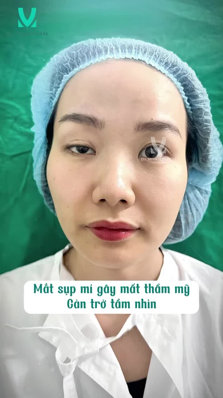 Cắt mí không chỉ giúp đôi mắt bạn to hơn, mà còn khiến gương mặt tươi tắn, trẻ trung và cuốn hút hơn.