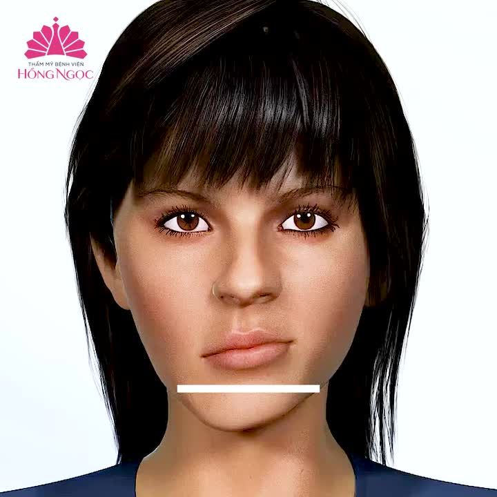 Phẫu thuật hàm mặt - Khắc phục triệt để tình trạng hô - móm - lệch hàm