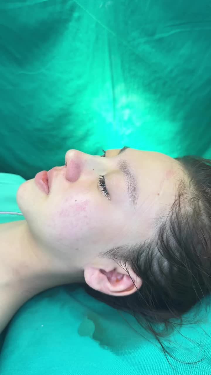 Case mũi cấu trúc Surgiform cho bạn gái đến từ Đăk Lăk.