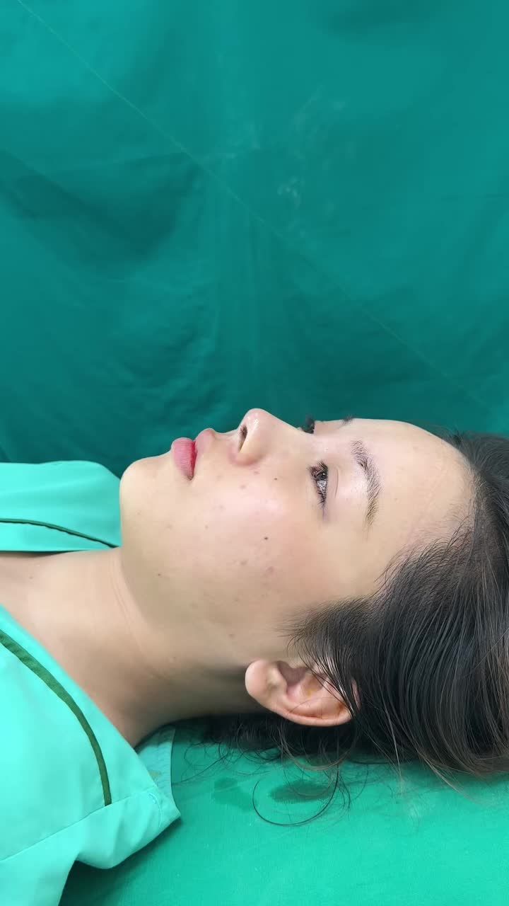 Case mũi bán cấu trúc vừa hoàn thành cho khách hàng đến từ Vũng Tàu!!