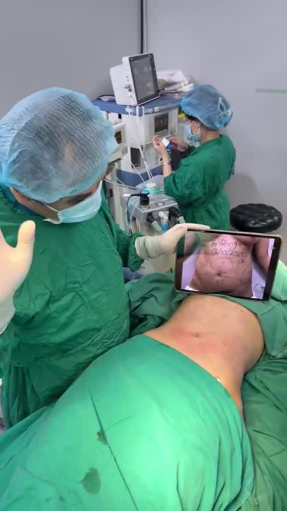 Hút kiệt mỡ bụng để lấy lại vóc dáng  xoá sổ “eo bánh mỳ” với Dr Vương !