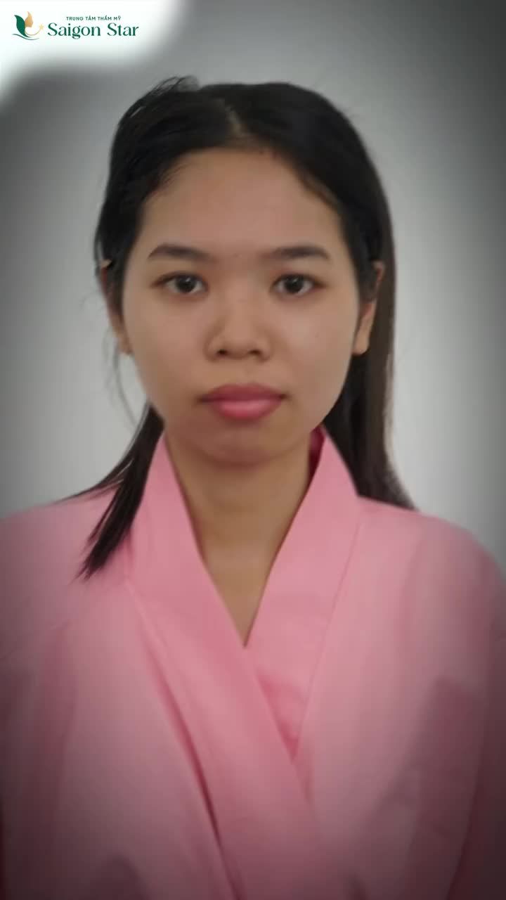 THIẾT CHỖ NÀO THÌ MÌNH "BÙ" CHỖ ĐÓ EM GÁI GENZ TÂN TRANG NHAN SẮC BẰNG COMBO NÂNG MŨI CẤU TRÚC + ĐỘN CẰM VLINE