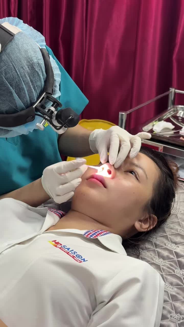 Chọn nâng mũi bền đẹp - Chọn Tuấn Linh nha!!
