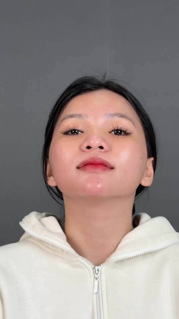 Mũi bọc sụn nhẹ nhàng mà đẹp cực kỳ cuốn hút!