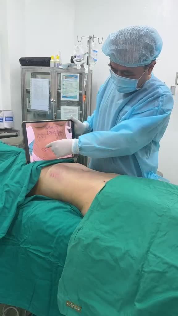 Hút sửa mỡ bụng cho bạn gái Đà Nẵng vô SG