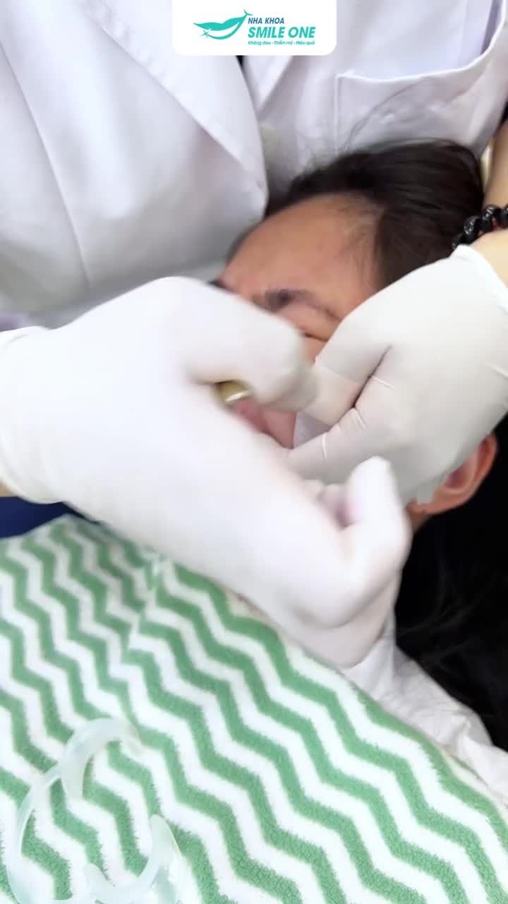 Cùng tháo niềng (tiếp) với nha khoa Smile One nhé! Lần này là tháo niềng mắc cài sứ nè!