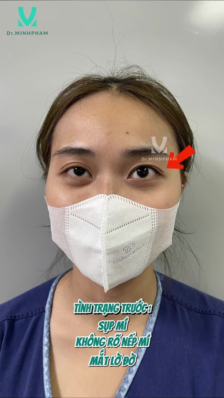 Đôi mắt mà đẹp, chẳng cần makeup cũng “auto xinh iu”