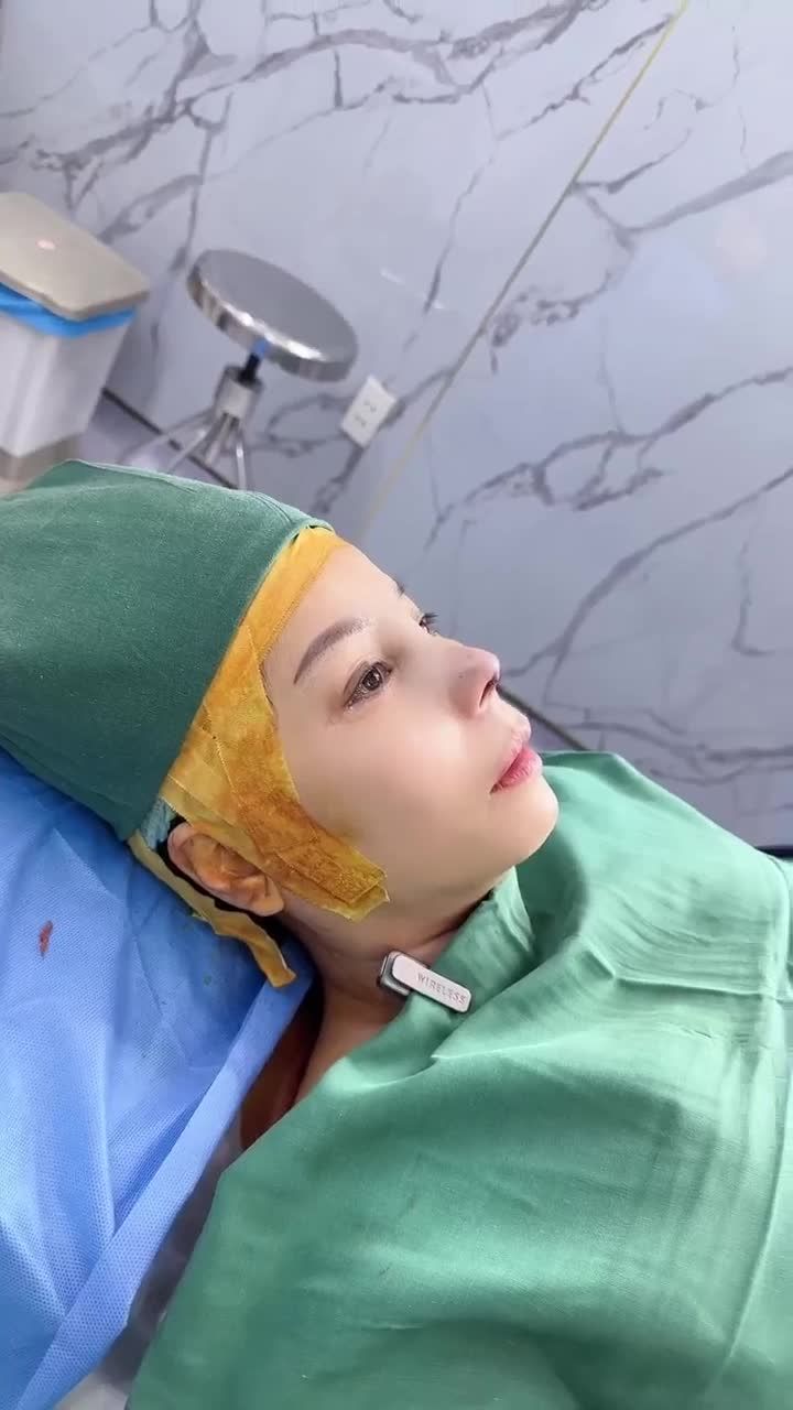 KẾT QUẢ SỬA LẠI MŨI HỎNG CHO CHỊ KHÁCH HÀNG VIỆT KIỀU MỸ