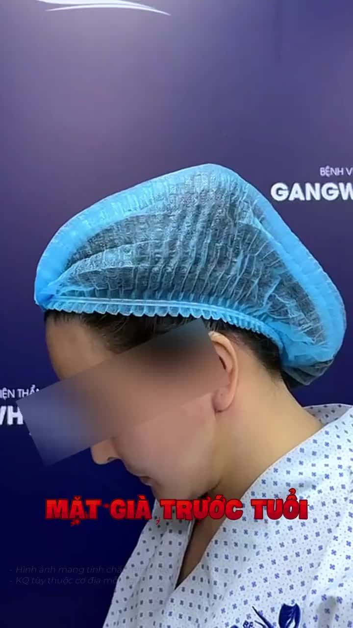 Làm đẹp mà sai 1 ly có thể đi rất nhiều dặm nhé các chị em