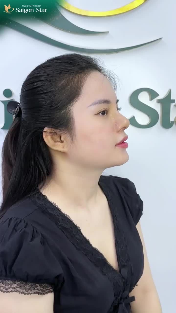 NGHE THEO LỜI TIKTOKER CÔ BA OANH - EM GÁI GENZ ĐI NÂNG MŨI TẠI BÁC SĨ HOẠT VÀ CÁI KẾT...