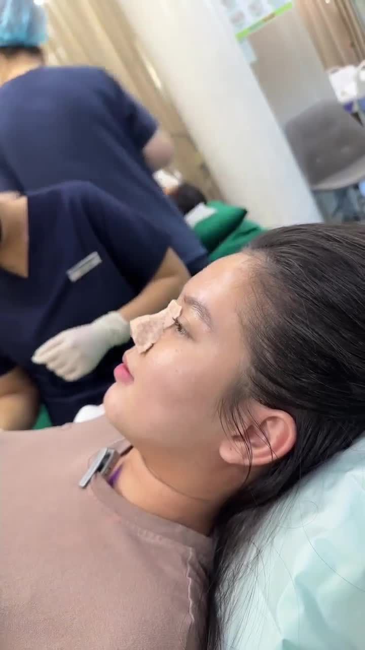 THÁO NẸP MŨI - CHÍNH THỨC CÔNG KHAI DÁNG MŨI SAU 10 NGÀY THỰC HIỆN