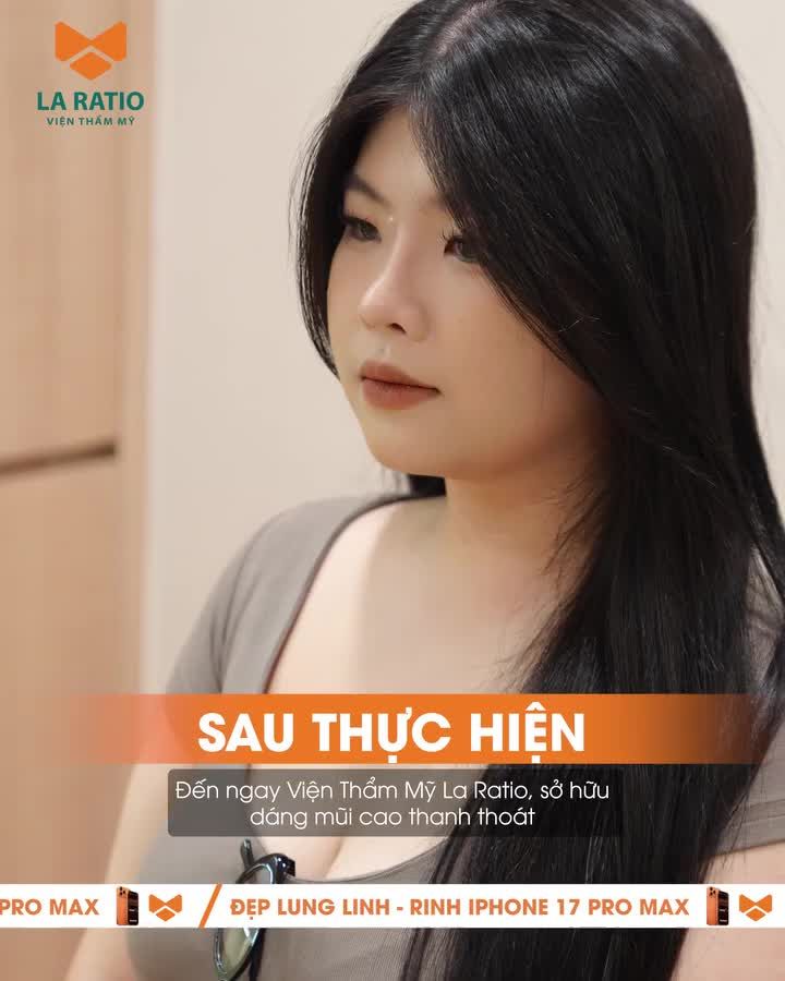 Mũi thấp, tẹt kém sang? La Ratio giúp bạn “lột xác" với dáng mũi cao thanh thoát – nhan sắc thăng hạng ngay tức thì!