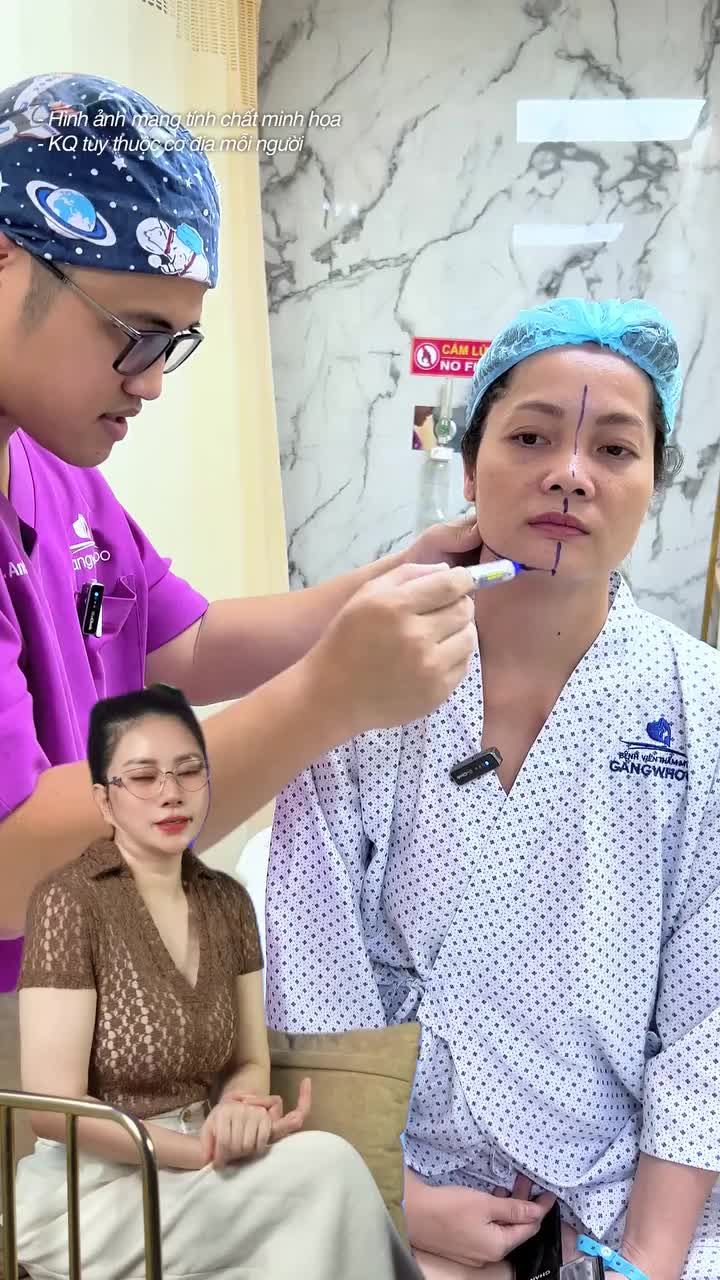 Đố chị em tìm được dấu vết Gọt Hàm nội soi 4k nhà Gangwhoo