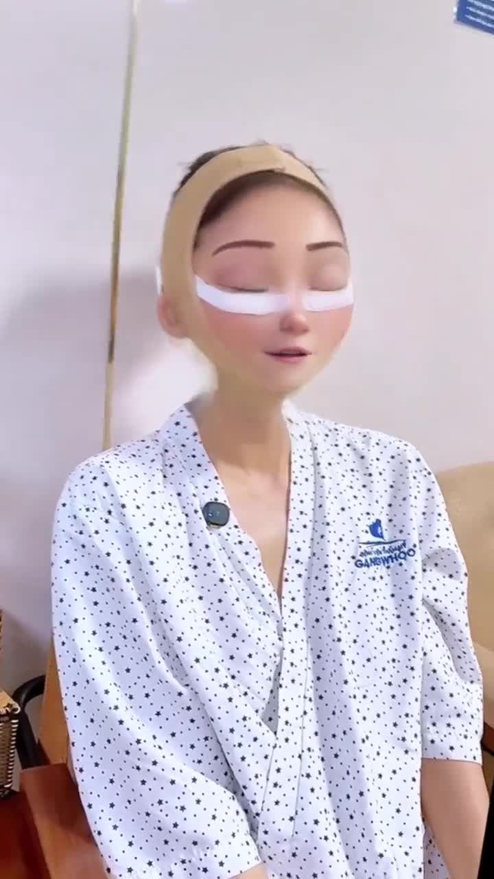 CHỊ KHÁCH HÀNG HẠNH PHÚC SAU KHI CĂNG DA MẶT SMAS TẠI GANGWHOO – TRẺ HƠN, KHÔNG ĐAU, KHÔNG SƯNG!