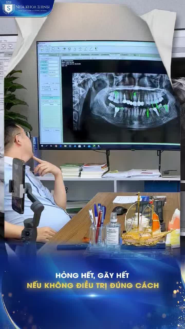 Cùng bác sĩ Hòa "giải cứu" chị khách mài răng, cắm răng bị lỗi