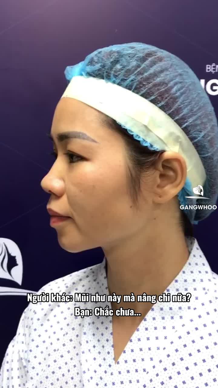 Bạn sẽ không ngờ mình lại xinh đến thế cho đến khi nâng mũi