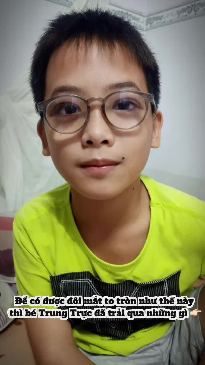 Kết quả sau 7 ngày PT vạt cơ trán tại Dr. Minh Phạm