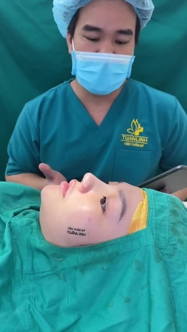 Case mũi bọc sụn sau 45 phút.