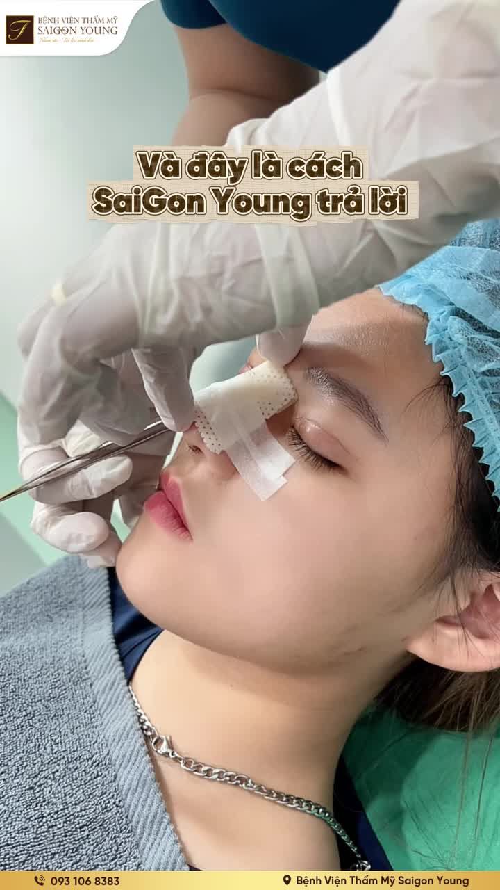 Tháo nẹp xong, mũi có đẹp liền? Xem ngay để biết ngay câu trả lời!!!